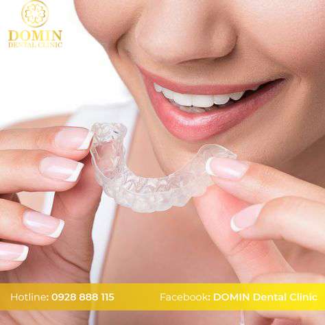 Niềng răng Invisalign 