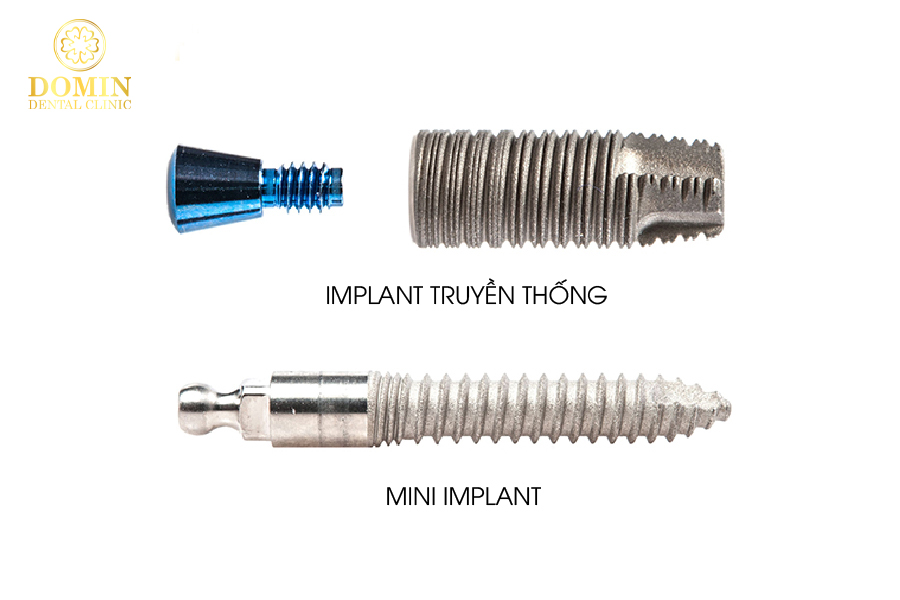 Cấy ghép mini implant