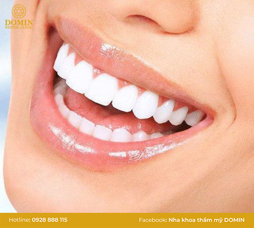 Ưu điểm khi bọc sứ ở hàm răng dưới 