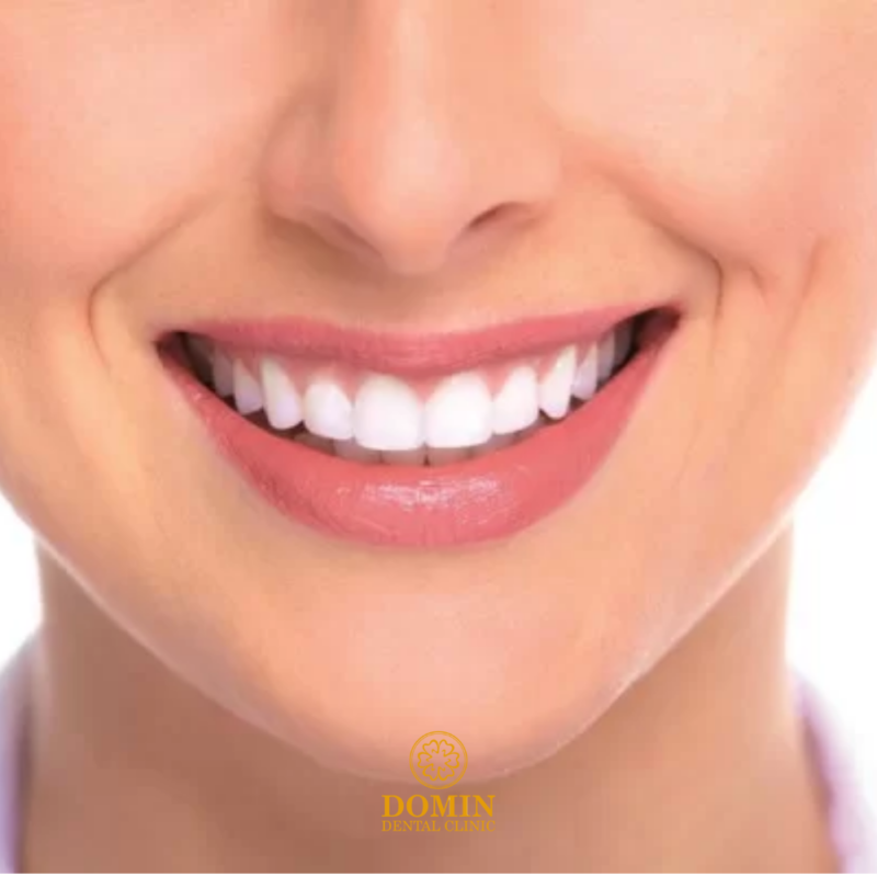 răng sứ đẹp tự nhiên