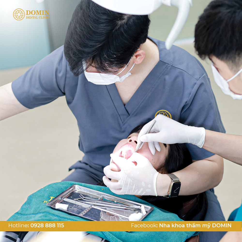 Cách khắc phục tình trạng răng sứ bị kênh